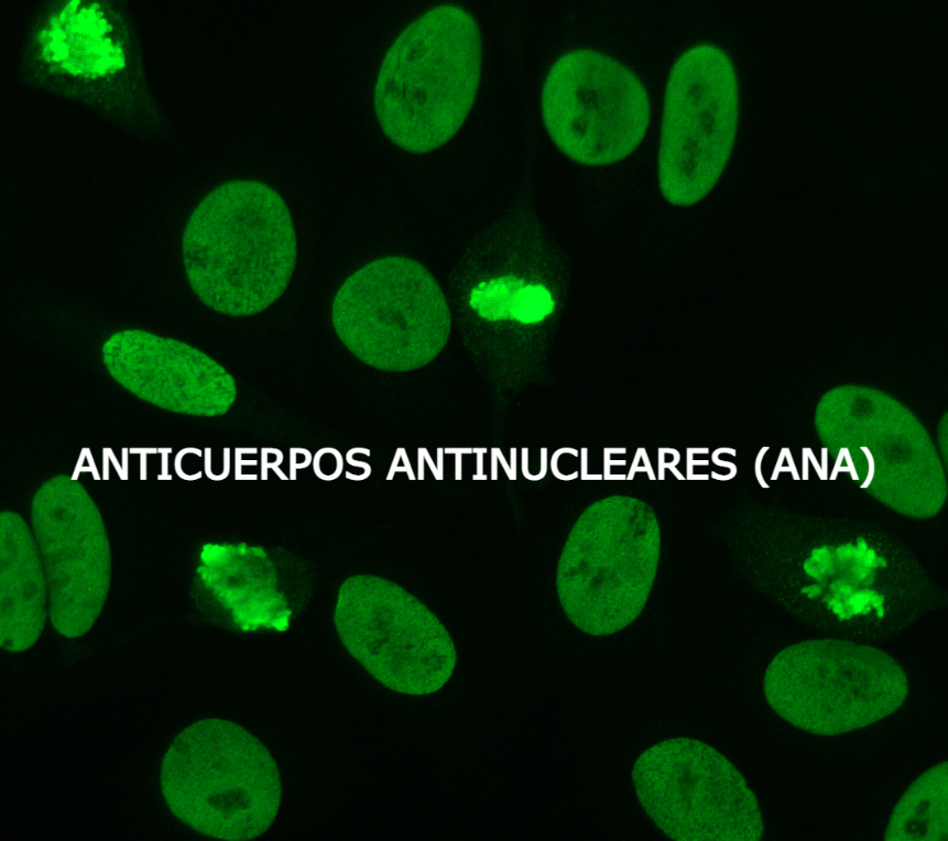 Anticorpo ANA negativo. Teste para lupus